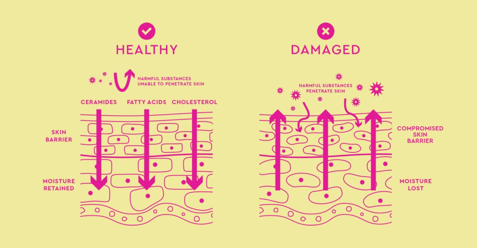 Split infographic with diagrams comparing “Healthy” and “Damaged” skin barriers. Healthy skin retains moisture and blocks harmful substances, while damaged skin shows moisture loss and external irritants penetrating the skin. All visuals and text are in pink on a light yellow background.